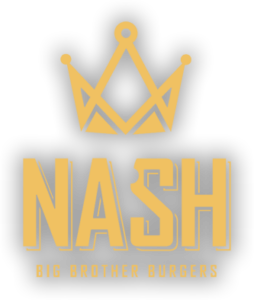 Nash Big Brother Burgers